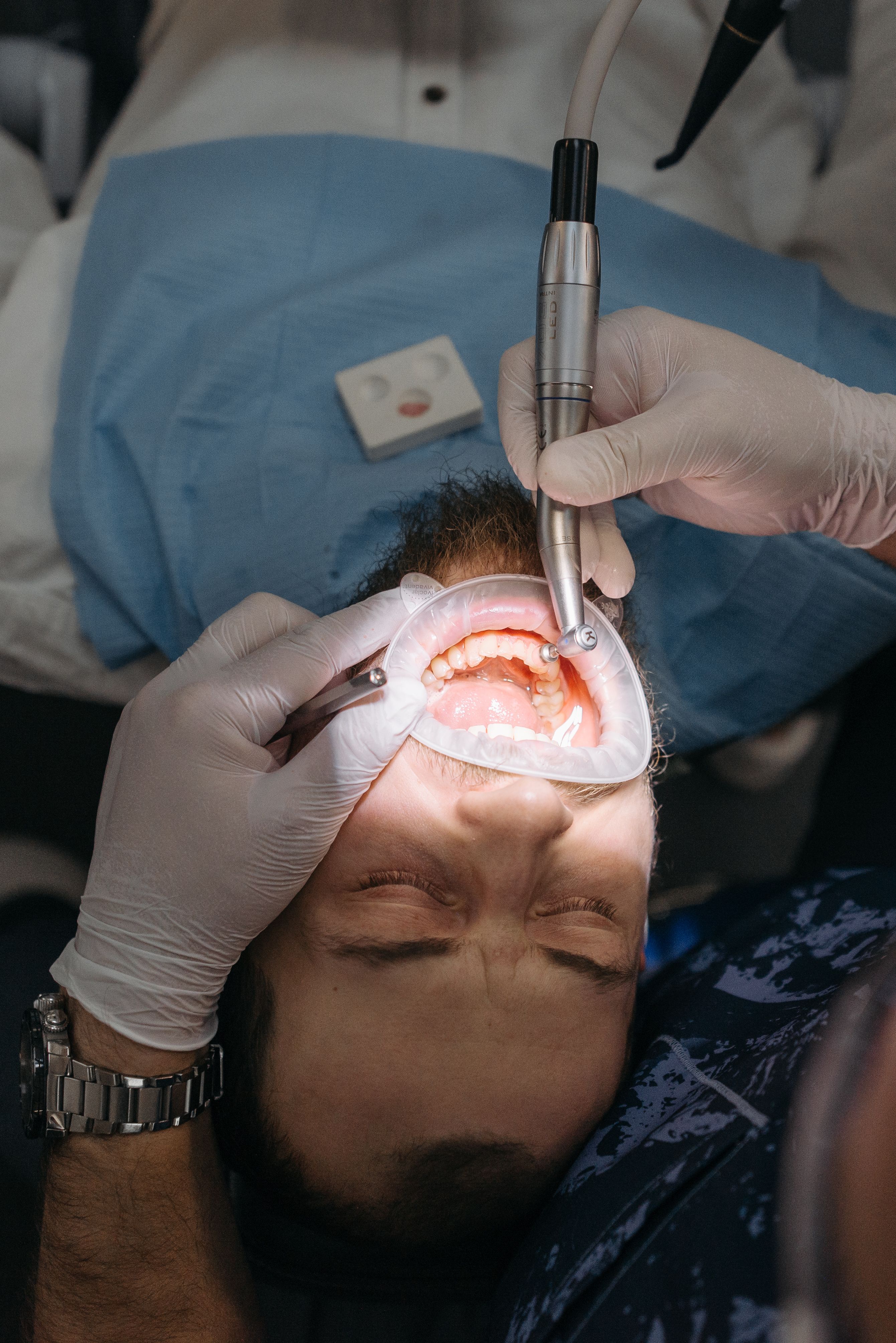 Kanal Tedavisi 3D dental render